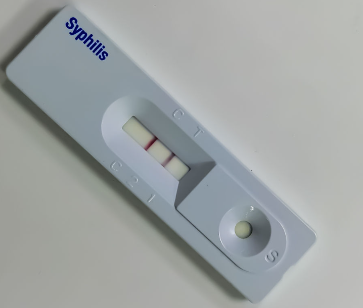 Strip tes cepat antigen sifilis